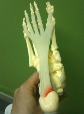 bottom of foot: that's the fascia from the toes into the heel.